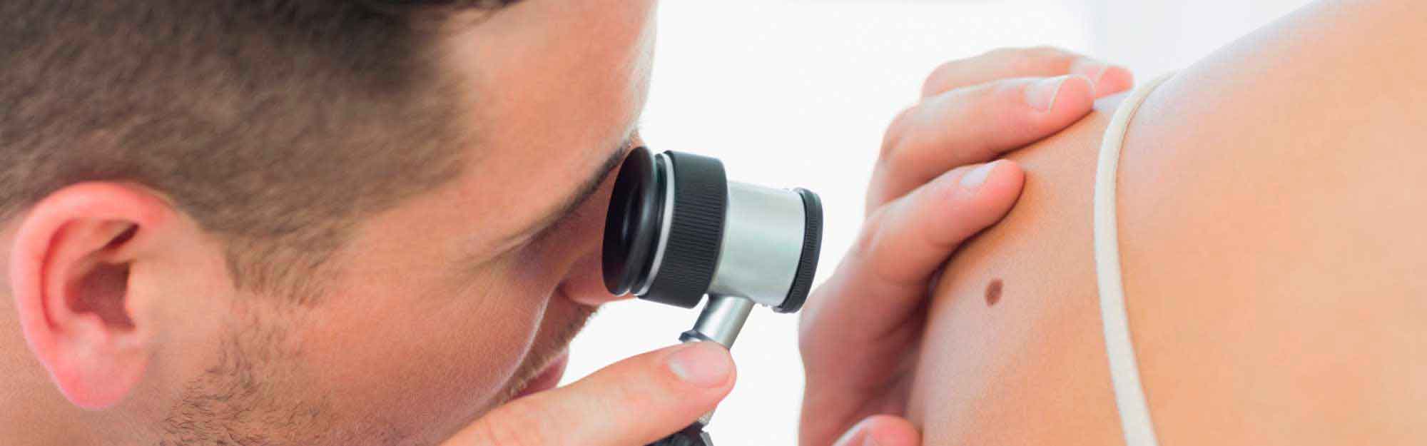 Skin Surgery Center Blog Hero - Most Common Skin Lesions